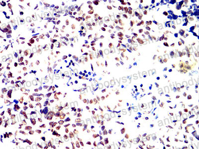 Валидация AntibodySystem RHD14102 (1348)