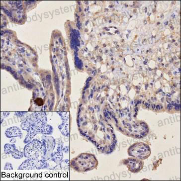 Валидация AntibodySystem RHE70205