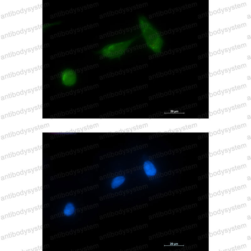 Валидация IF - AntibodySystem RHJ47101