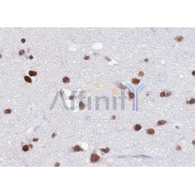 Валидация Affinity AF5261 - 2771