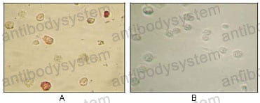 Валидация AntibodySystem RVV44401 (4205)