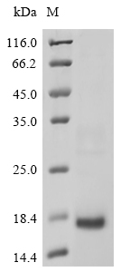 SDS-PAGE