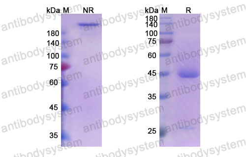 Валидация SDS-PAGE - AntibodySystem DHJ28402