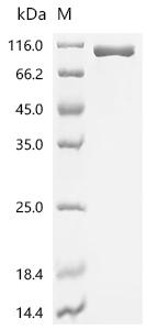 SDS-PAGE