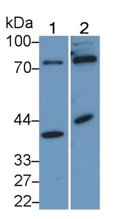 21815