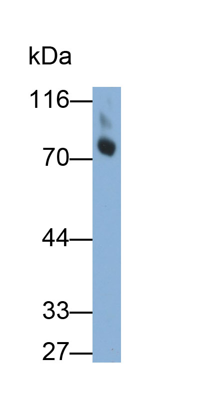 32570