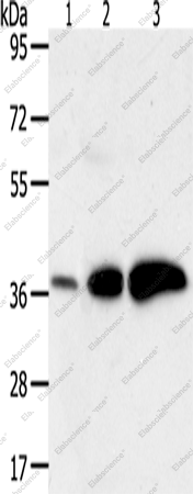 Вестерн-блоттинг, AKR1C1, ткань рака печени человека, инфильтративной протоковой карциномы молочной железы и плода человека