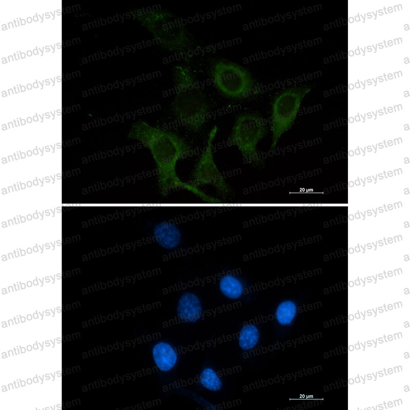 Валидация IF - AntibodySystem RHG64001