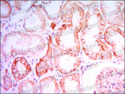 Валидация AntibodySystem RHF99303
