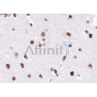 Валидация Affinity DF12094 - 6201