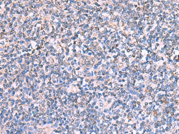 Иммуногистохимия, FDXR, ткань миндалин человека