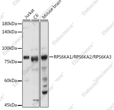 Вестерн-блоттинг, RPS6KA1/RPS6KA2/RPS6KA3, различные клеточные линии