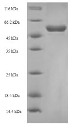 SDS-PAGE