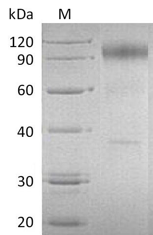 SDS-PAGE