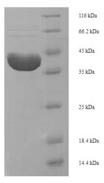 SDS-PAGE