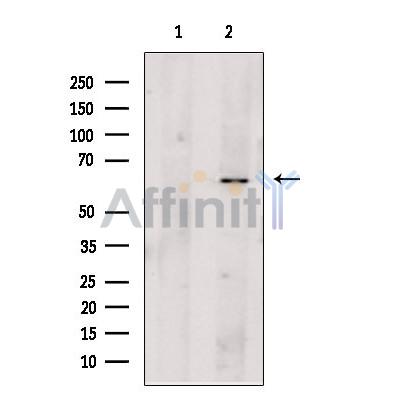 Валидация Affinity DF6004 - 17224