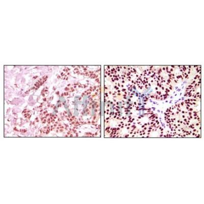 Валидация Affinity BF0111 - 5144