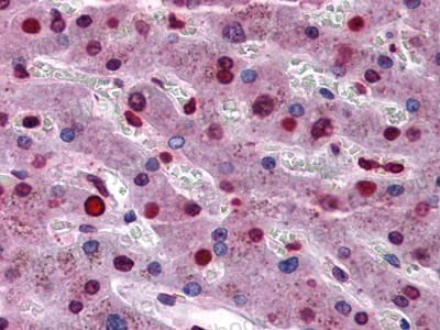 Валидация AntibodySystem RHE27704