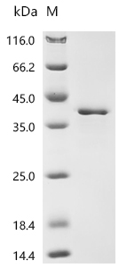 SDS-PAGE