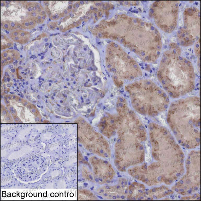 Валидация AntibodySystem RHP05001