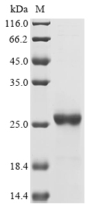 SDS-PAGE