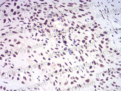 Валидация AntibodySystem RHA88902 (224)