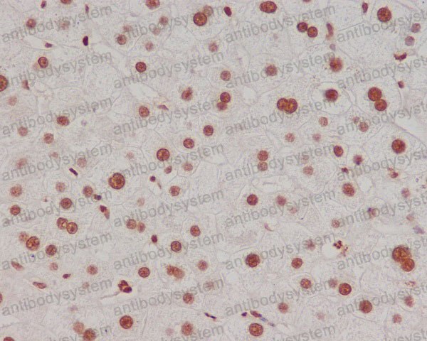 Валидация AntibodySystem RHF62716 (2621)