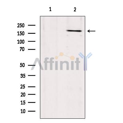 Валидация Affinity DF2913 - 13647