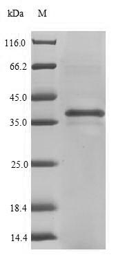 SDS-PAGE