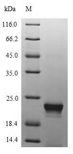 SDS-PAGE