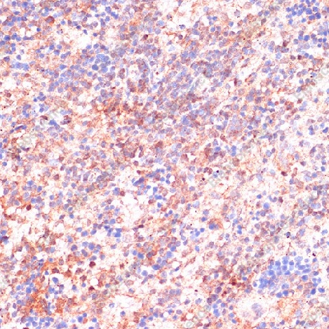 Иммуногистохимия, CDC20, ткань селезенки крысы