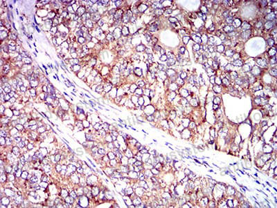 Валидация AntibodySystem RHC98602 (1229)