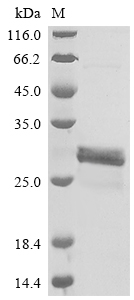 SDS-PAGE