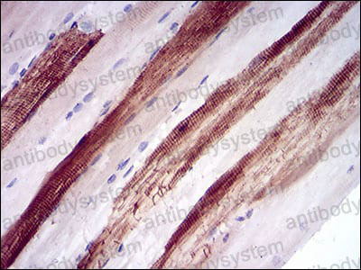 Валидация AntibodySystem RHB97302