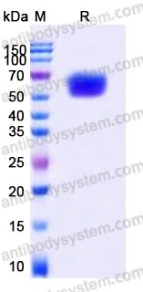 AHD62604, SDS-PAGE