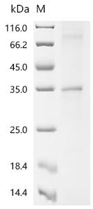 SDS-PAGE