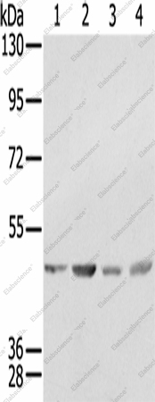 Вестерн-блоттинг, SSB, клетки K562, 231, Raji и HeLa