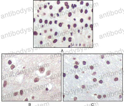 Валидация AntibodySystem RHE37704 (2124)