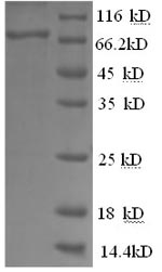 SDS-PAGE