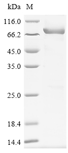 SDS-PAGE