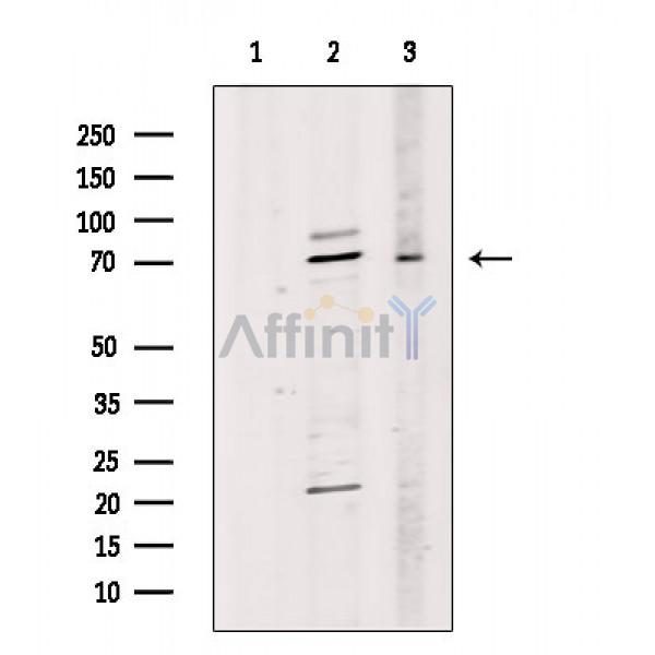 Валидация Affinity DF6847 - 18420