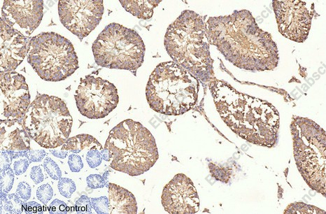 Иммуногистохимия, beta Tubulin, ткань семенника мыши