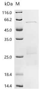 SDS-PAGE