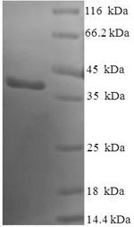 SDS-PAGE