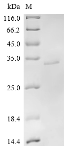 SDS-PAGE
