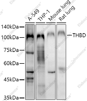 Вестерн-блоттинг, CD141/Thrombomodulin, различные клеточные линии