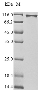 SDS-PAGE