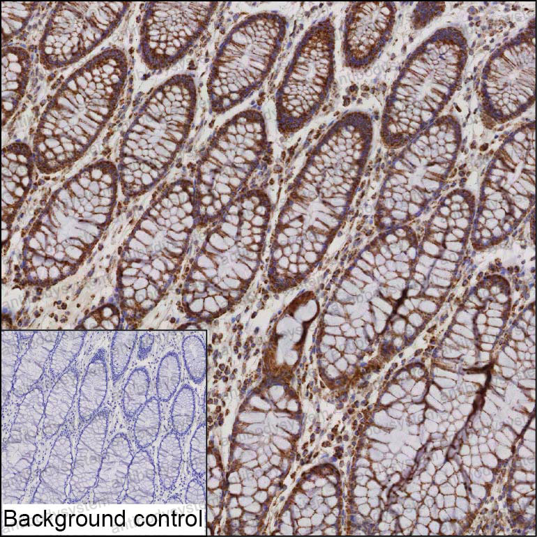 Валидация AntibodySystem RHD07401