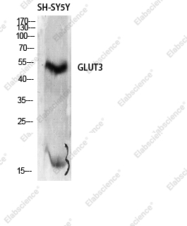 Вестерн-блоттинг, GLUT-3, ткань почки мыши