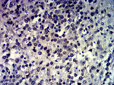 Валидация AntibodySystem RHE93108